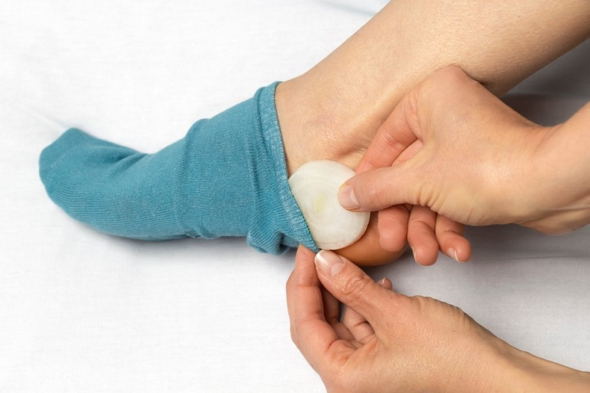 Ставете кромид во чорапите преку ноќ: Проблемите ќе исчезнат како од шега