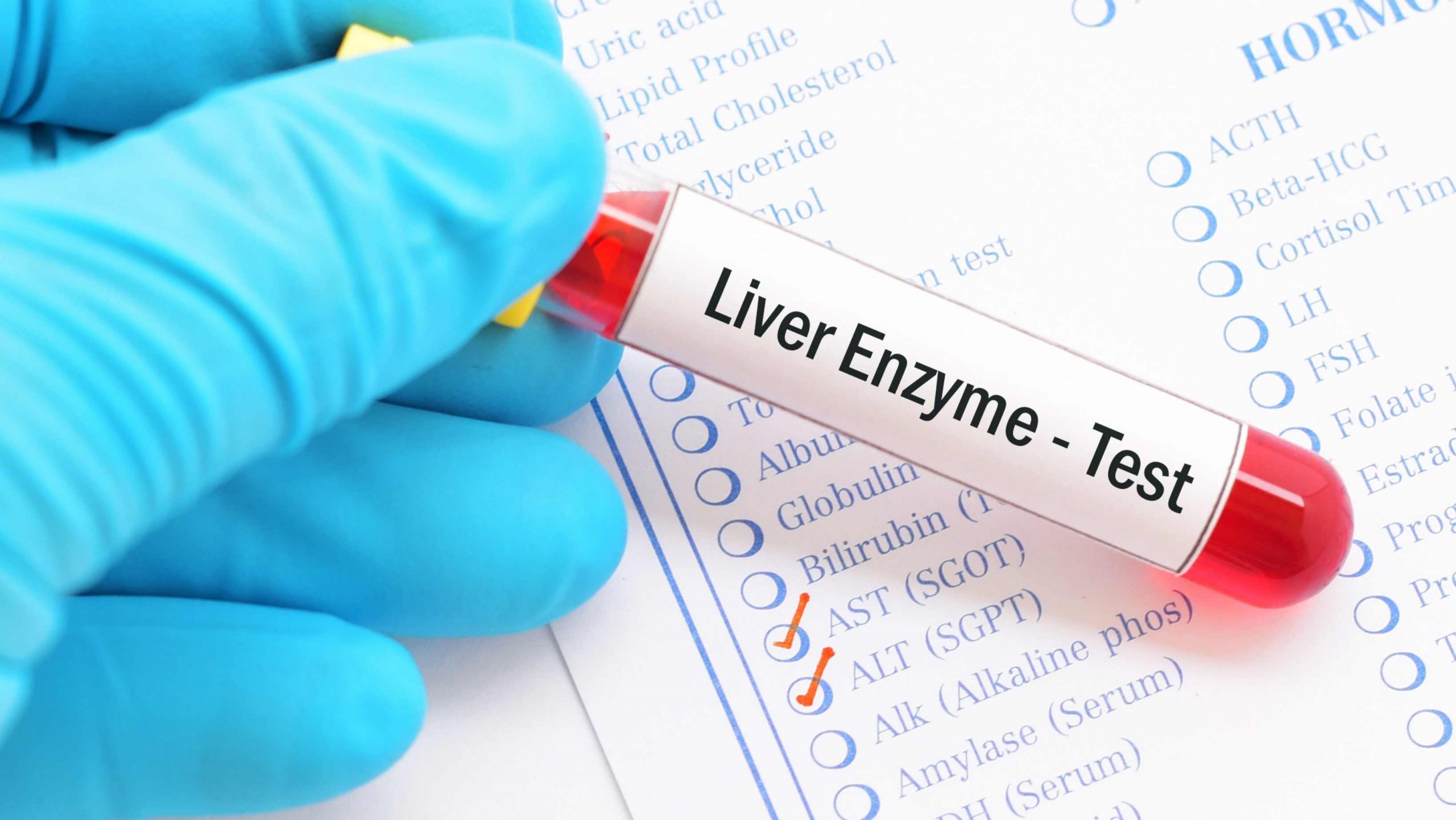 Покачени ЕНЗИМИ на ЦРН ДРОБ (ALT;AST) – Што треба да знаете?