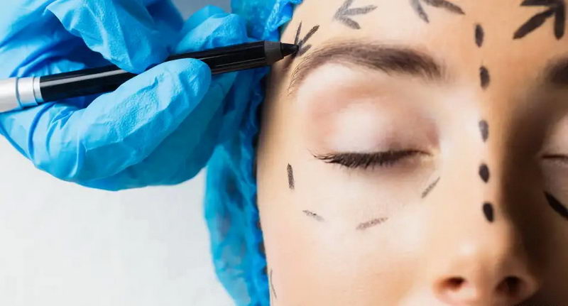 Разубавување со ризик: Се истражува увоз на ботокси и филери