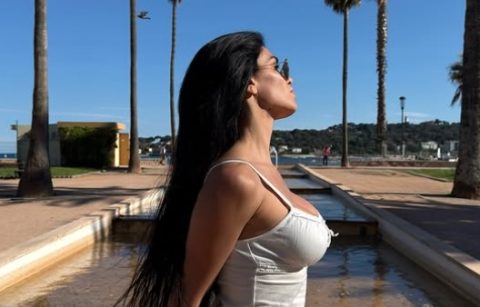 „Докторот ми извади половина од носот“: Српската манекенка поминала низ пекол со хирургот