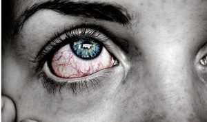 Симптоми на висок холестерол: Како да го препознаете навреме