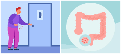 Симптоми кои ве срам да ги споделите со лекар, но може да се знак за ректален рак