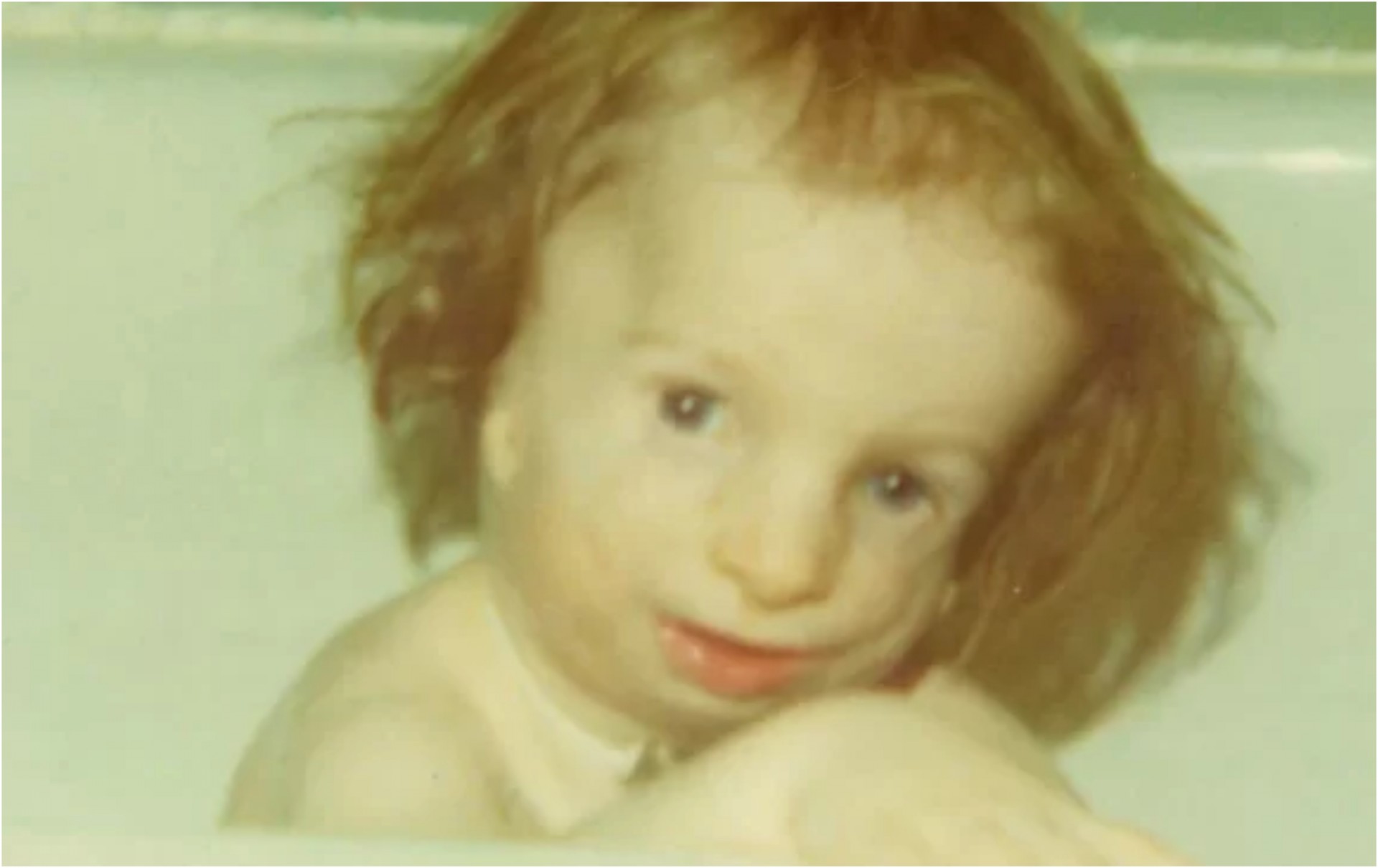 Бебе родено без уши и очни вдлабнатини било напуштено по раѓањето, сега ја споделува својата приказна