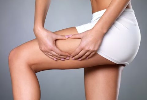 3 решенија за отстранување на целулитот и крај на кожата како кора од портокал