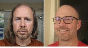 (ФОТО) Почнал да оќелавува, потоа ја избричил главата и воодушевил: „Изгледаш 15 години помладо“