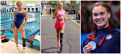 „Ајкула ми ја одгриза ногата – учев одново да одам со протеза, сега сум професионален пливач“