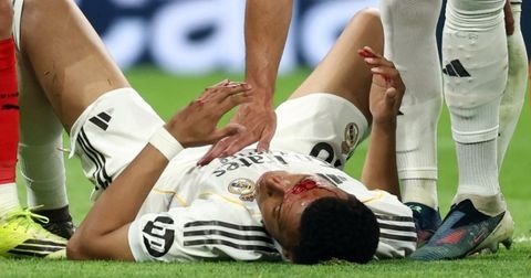 Првата ѕвезда на Реал има конци на лицето, не тренира пред Баерн Минхен