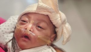 (ФОТО) По четири месеци борба, девојчето со тежина од 400 грама си отишло дома