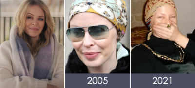 Кајли Миног (57) тајно водела втора битка со рак на дојка – го одложувала третманот по првата дијагноза со надеж дека ќе стане мајка