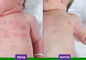 Клинички потврдена нега за најчувствителната бебешка кожа