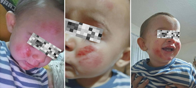 Мајка со деца нападната од кучиња во кичевско: „Малото ми го извлекоа од раце, го влечеа по бекатон, доживеавме хорор“
