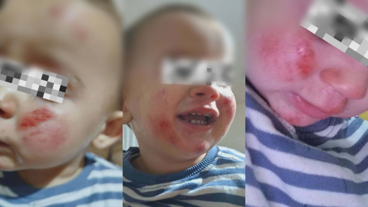 ФОТО: Домашни расни кучиња нападнале мајка со малолетни деца во кичевско, едното дете има повреди по лицето!