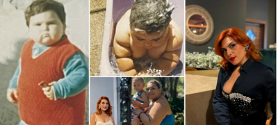 Габриела Јанческа имала 20kg на една година, а 131kg на 23: „Бубрегот од левата страна ми беше откачен од салото, сега сум минус 60kg“