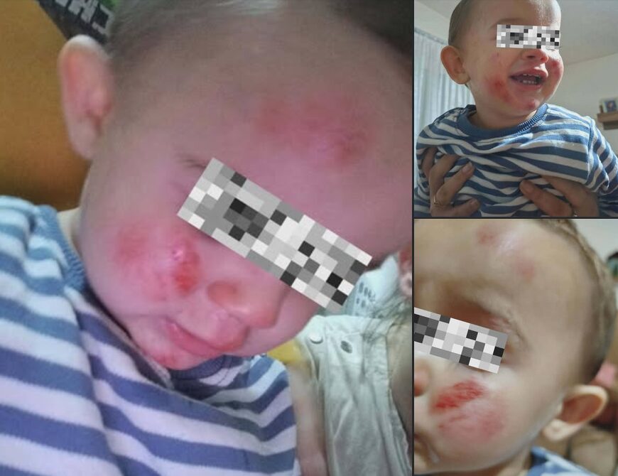 Домашни кучиња нападнале мајка со две деца во Кичево