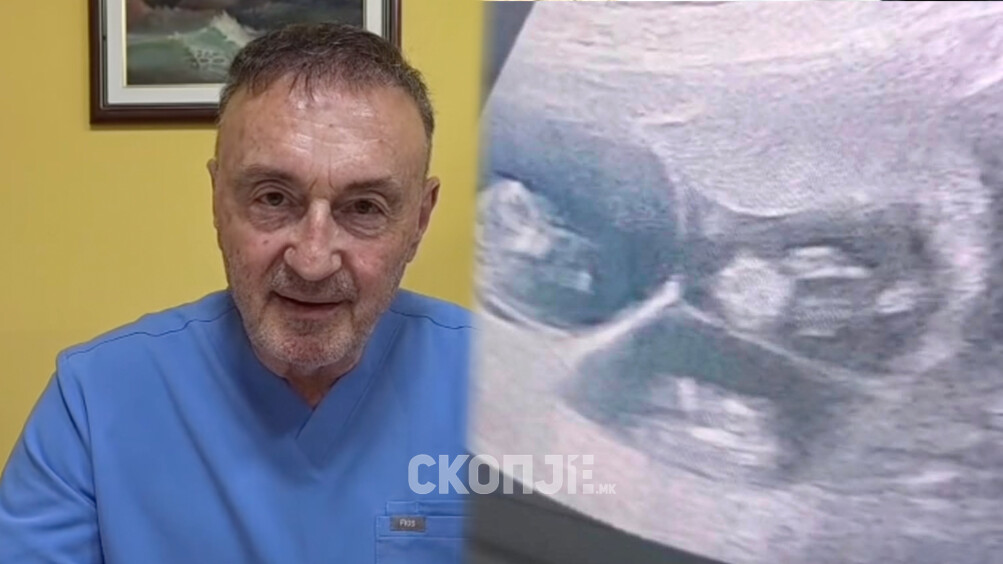  Д-р Трпчевски откри редок случај: Жена на 58 години остана бремена со тројка по ин витро оплодување