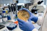 CRISPR како третман кога антибиотици не можат да се применат?!