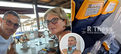 Прва фотографија и изјава на Србинот повреден во авионот на Ryanair: „Се сеќавам на експлозијата, го слушам звукот штом затворам очи“