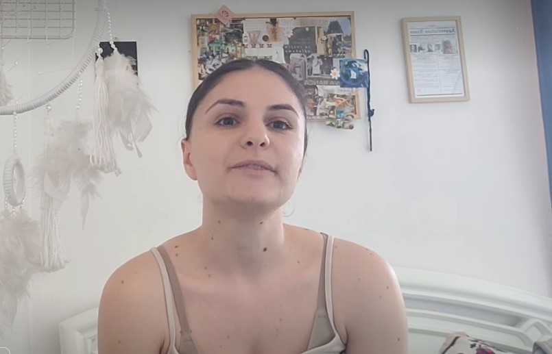 ФИЗИОТЕРАПЕВТКА ОД КУМАНОВО, БАРА ПОМОШ: Тврди дека со години живее во страв поради семејно насилство од нејзиниот татко