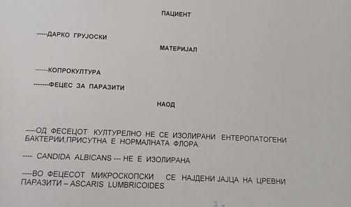 Пронајдени јајца од цревен паразит кај гостиварец по пиење на водата со фекалии