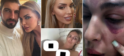 Хрватска старлета објави фотка на која е врзана гола - покажа што ѝ правел дечкото-насилник, пред да ја приведе полиција