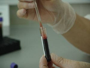 38 случаи на западнонилска треска во Македонија, да се почитуваат препораките за заштита