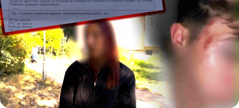 „Го подавале како топка, го држеле до дрво додека го удирале со боксирач“ – потресно сведоштво на мајката чие дете е натепано во Влае