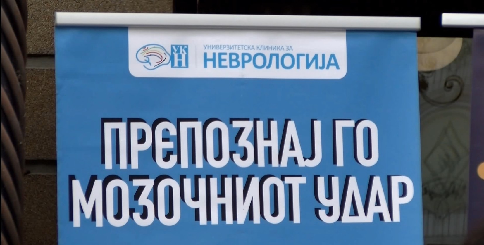 На Неврологија третирале 16 годишен пациент со мозочен удар